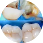 COROAS E PEÇAS COROAS E PEÇAS