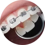 ORTODONTIA ORTODONTIA